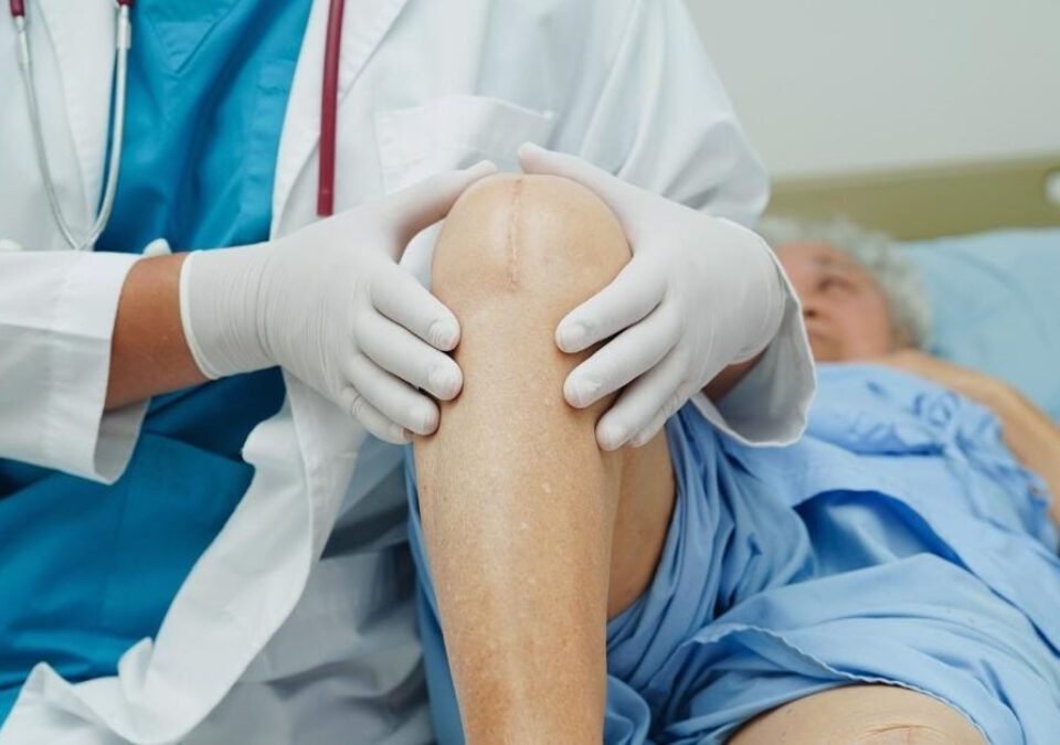 Everything You Need to Know About Knee Replacement Surgery in Faridabad