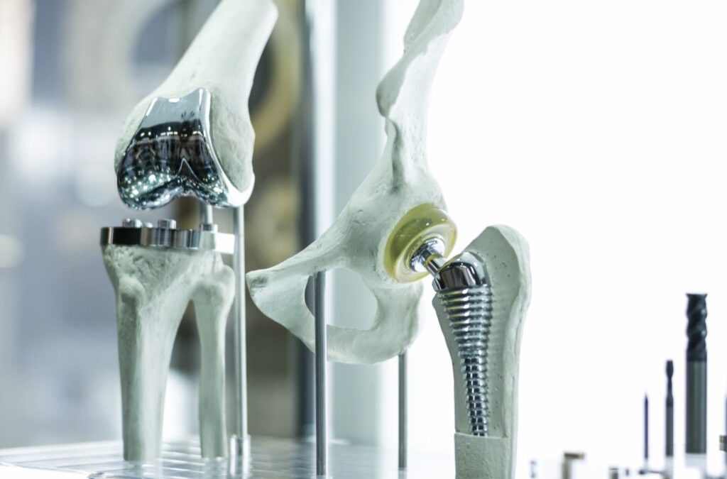 Joint replacement surgeon in Faridabad Dr. Sunil Choudhary UK trained knee hip shoulder arthroplasty specialist Bone Joints Clinic