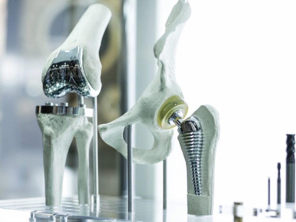 Joint replacement surgeon in Faridabad Dr. Sunil Choudhary UK trained knee hip shoulder arthroplasty specialist Bone Joints Clinic